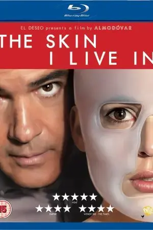 Lớp vảy tôi mang Lớp vảy tôi mang